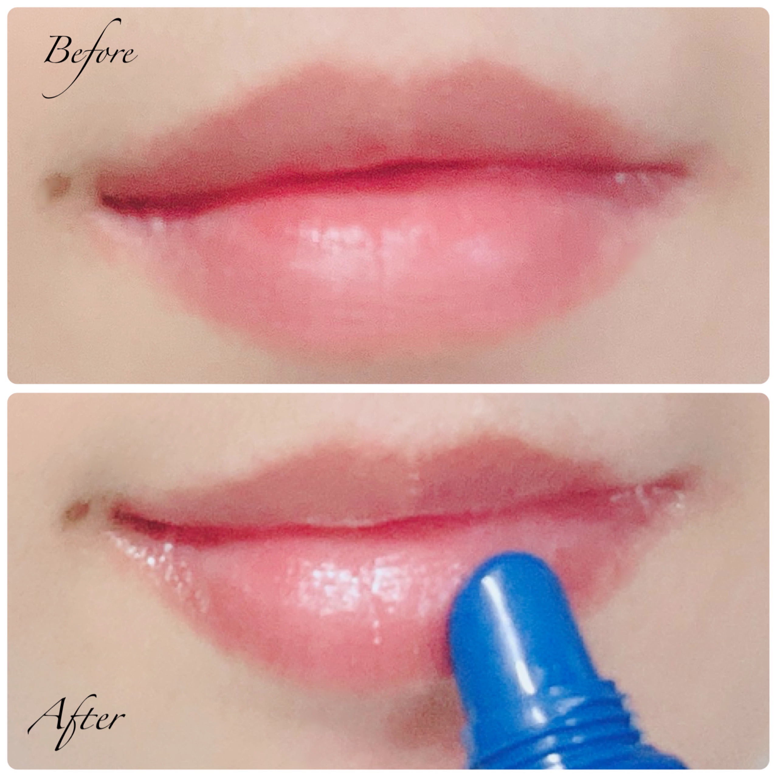 タカミリップ/タカミ/リップ美容液を使ったクチコミ（3枚目）