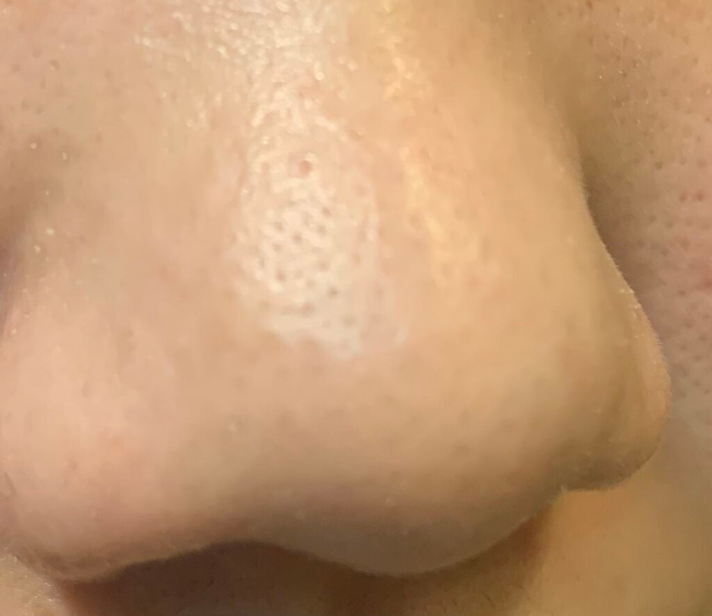 女子高校生マサトシ on LIPS 「ノーモアブラックヘッド※2枚目、3枚目の写真はノーマルで撮りま..」(3枚目)