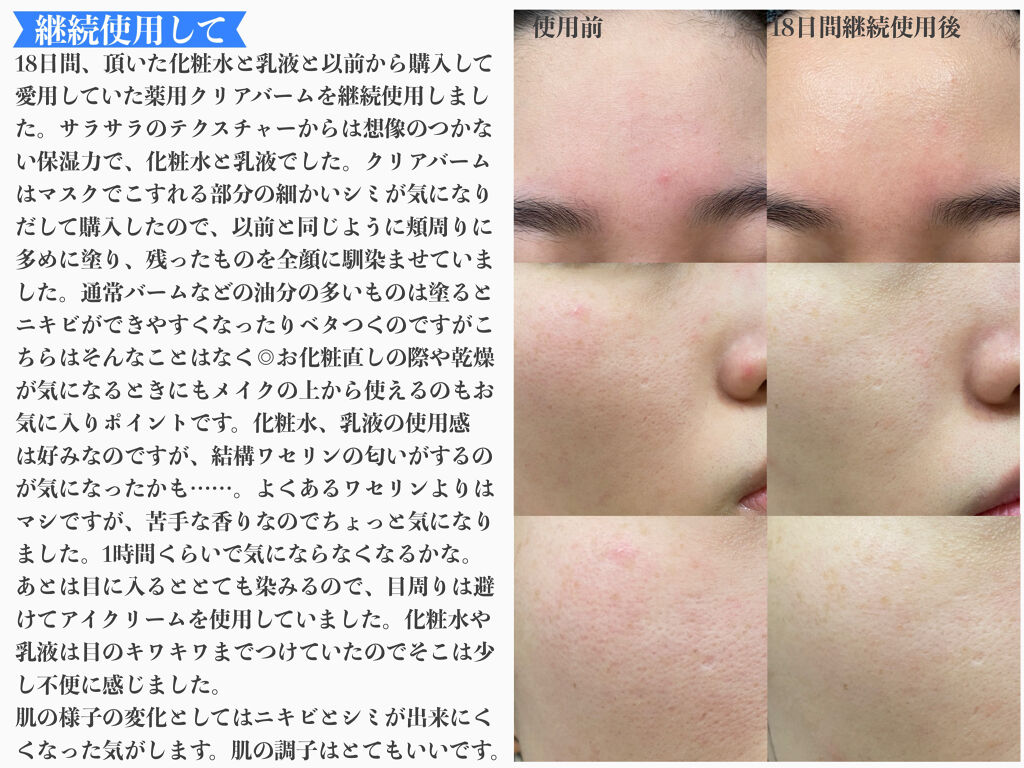 イハダ 薬用クリアバーム/IHADA/フェイスバームを使ったクチコミ（3枚目）