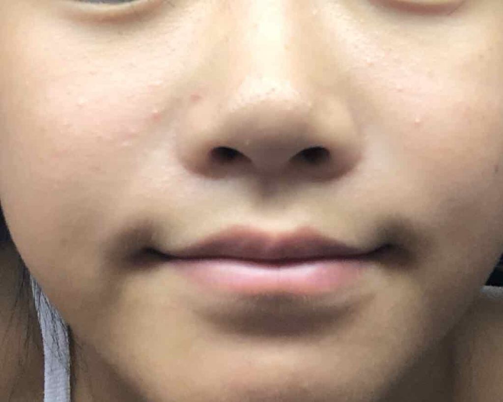 薬用美白 美容液/DAISO/美容液を使ったクチコミ（2枚目）