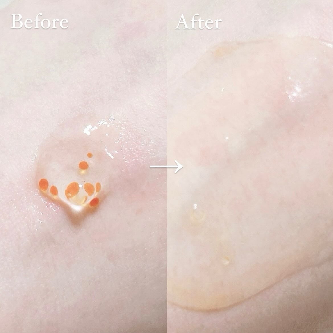 アスタリライズV3エッセンス/アトレージュ AD+/美容液を使ったクチコミ(3枚目)