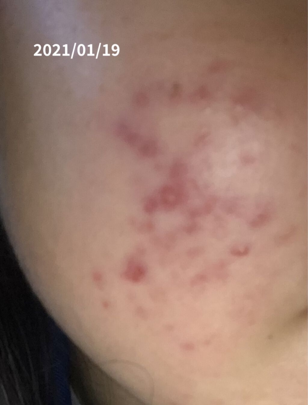 チョコラBBプラス (医薬品)/チョコラBB/その他を使ったクチコミ（2枚目）