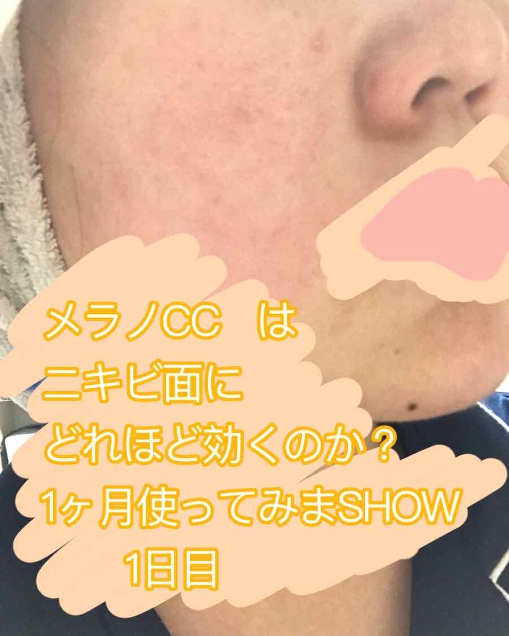 白潤 薬用美白乳液/肌ラボ/乳液を使ったクチコミ（1枚目）