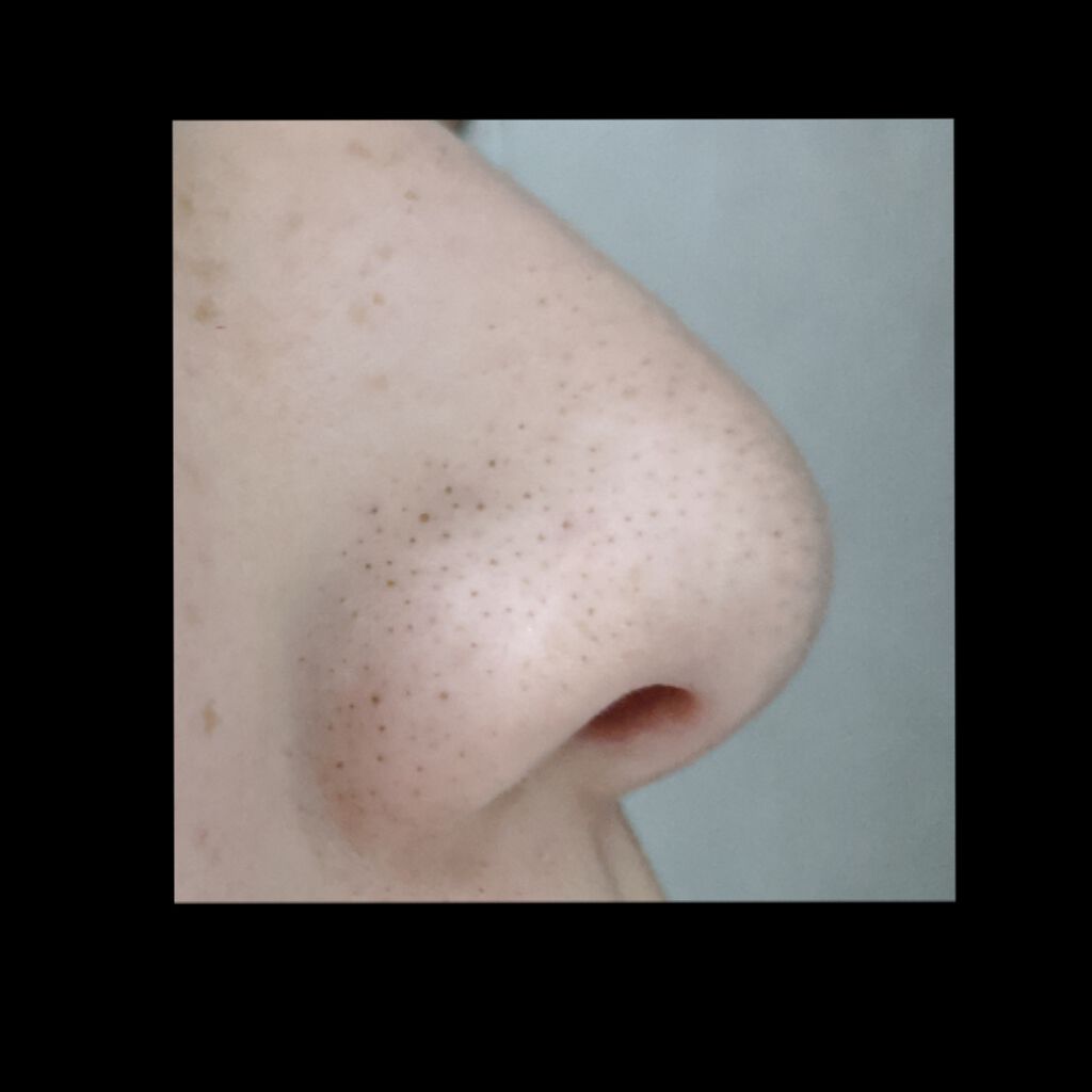 オバジC 酵素洗顔パウダー/オバジ/洗顔パウダーを使ったクチコミ（3枚目）