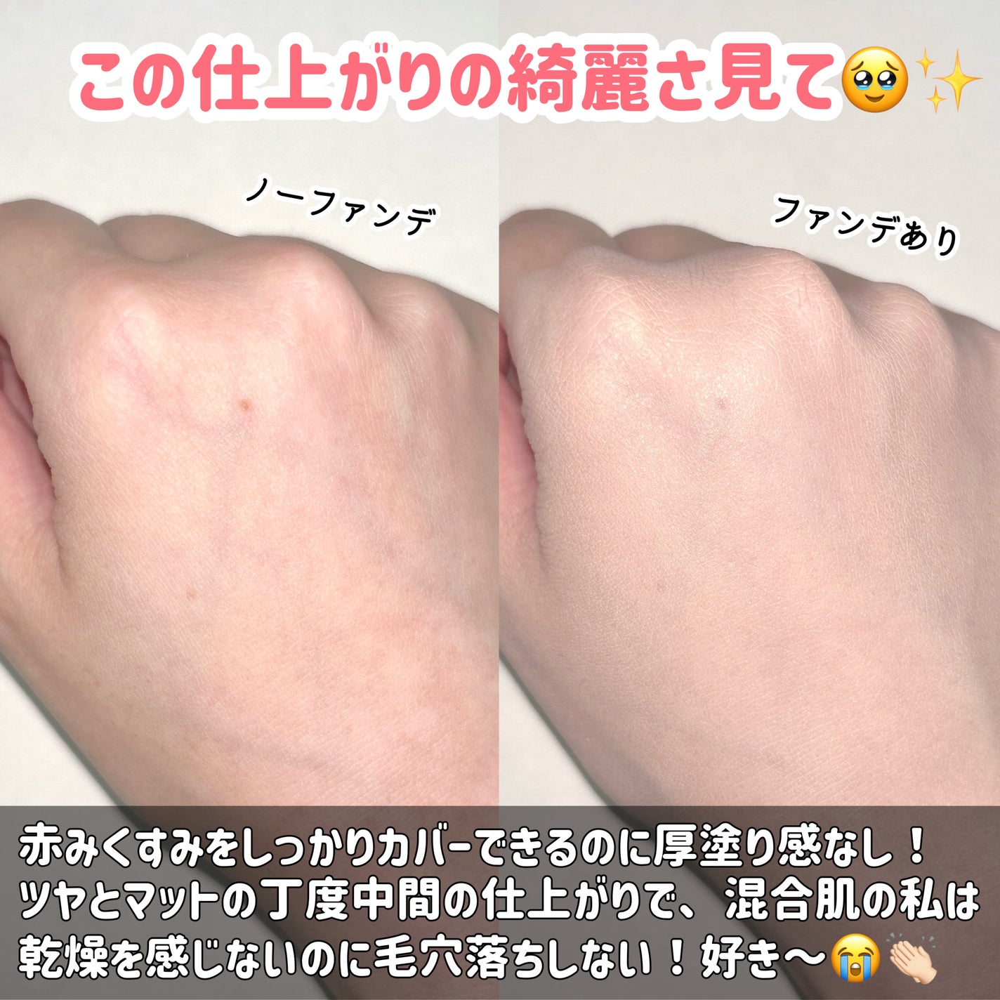 ピンクティーツリーカバープライマークッション/APLIN/クッションファンデーションを使ったクチコミ(5枚目)