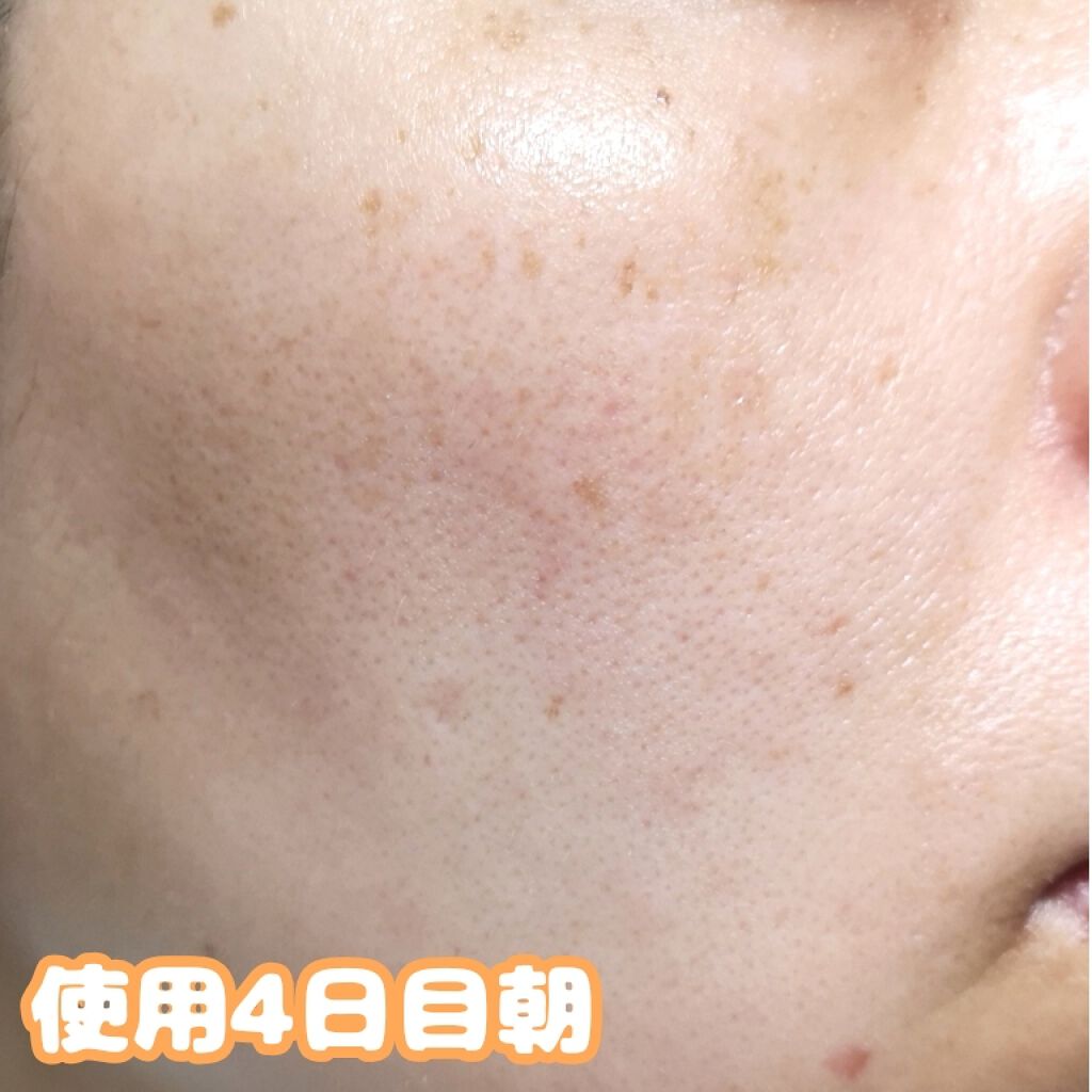 ホワイトニングクリア ローション/d プログラム/化粧水を使ったクチコミ（2枚目）