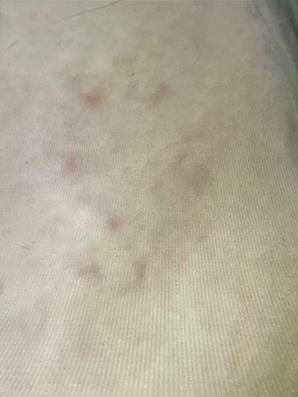 N10+Z1フェイスセラム /The Ordinary/美容液を使ったクチコミ(3枚目)