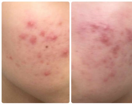 を使ったクチコミ(1枚目)