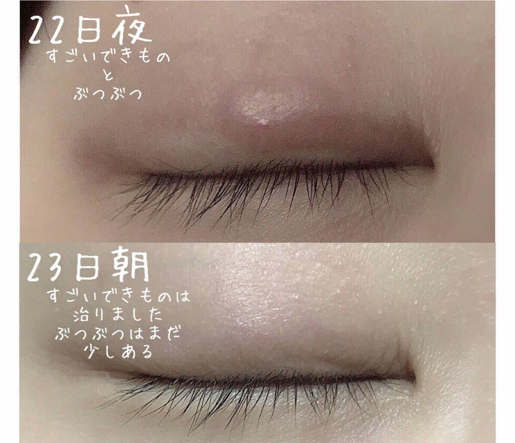 メディカルクリームG（薬用クリームG）/メンターム/ハンドクリームを使ったクチコミ（2枚目）