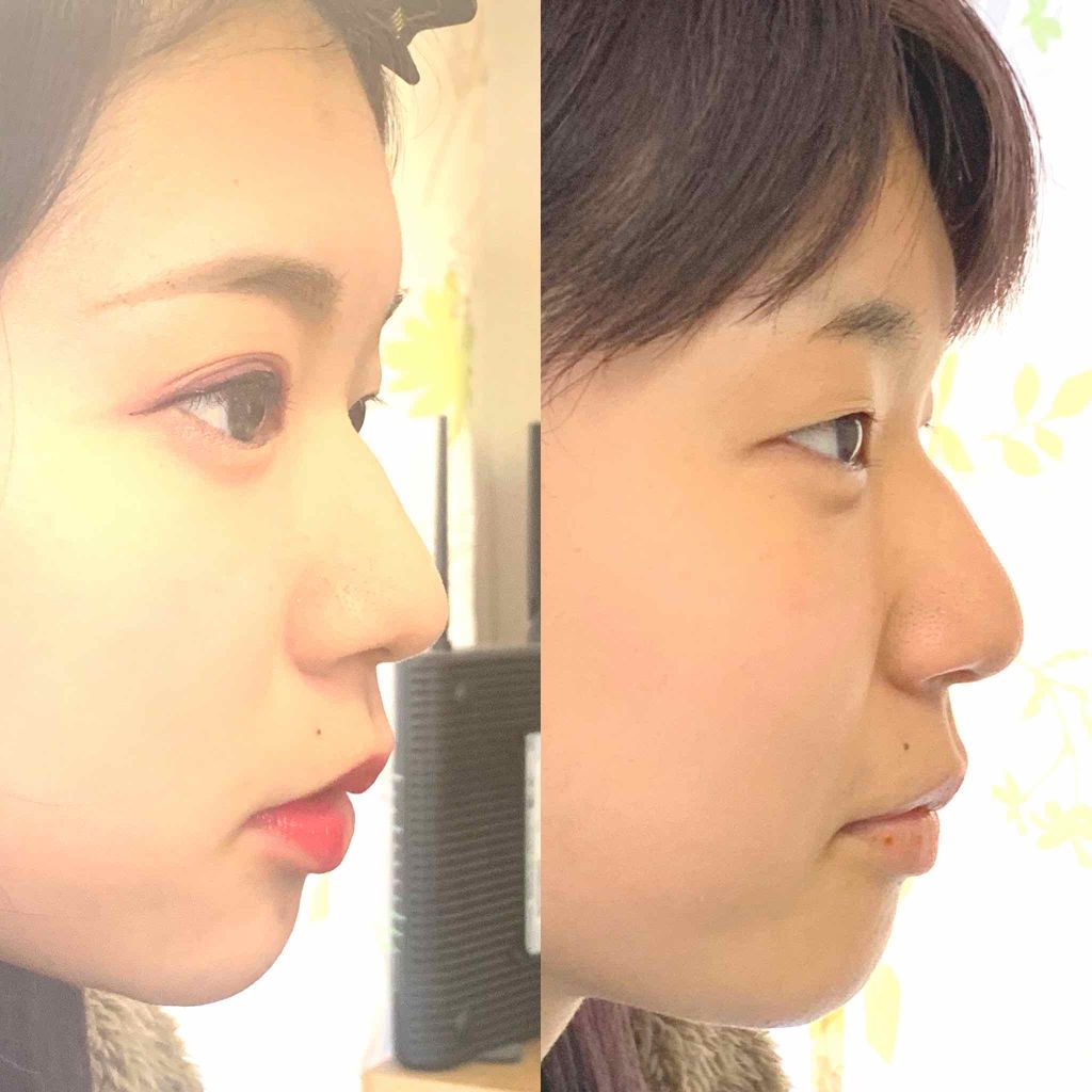 orangeð on LIPS ã仿¥åã ã¡ã®ã¡ã€ã¯ãèŠãŠãããããïŒãã¡ã坿ãåã ã¡ã®ã¡ã€ã¯..ãïŒ1æç®ïŒ