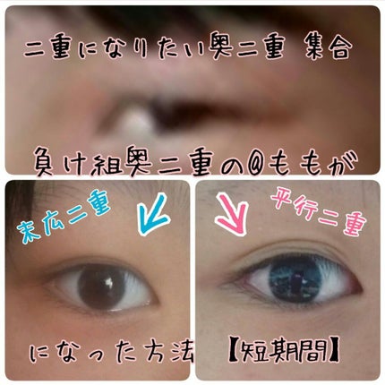 ダブルアイリキッド/Automatic Beauty/二重まぶた用アイテムを使ったクチコミ(1枚目)