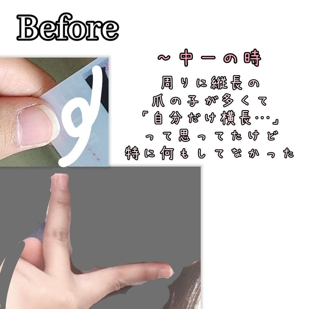 ウィンマックス キューティクルオイル/DAISO/ネイルオイル・トリートメントを使ったクチコミ(2枚目)