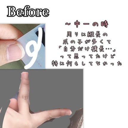 ウィンマックス キューティクルオイル/DAISO/ネイルオイル・トリートメントを使ったクチコミ(2枚目)