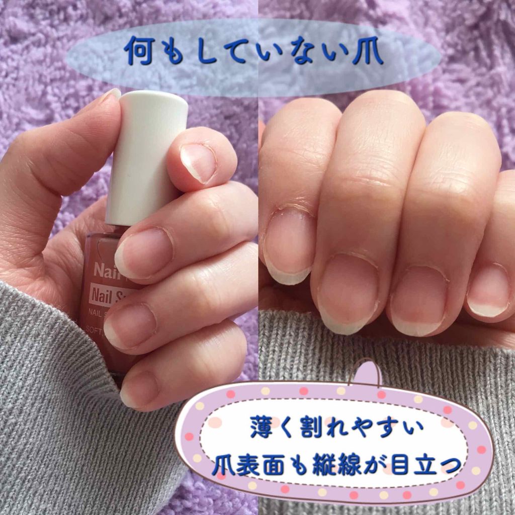 ネイルサポート ピンク/ネイルネイル/ネイルベースコートを使ったクチコミ(2枚目)