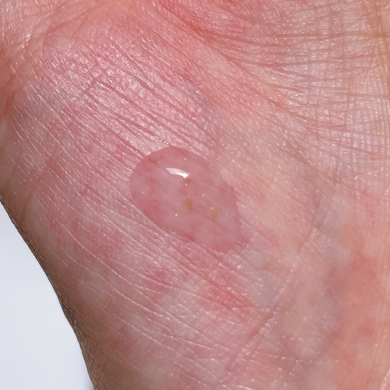 シューマジショットゴールド糸リフティングアンプル/MEDITHERAPY/美容液を使ったクチコミ（3枚目）