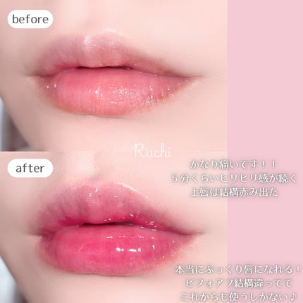 ボリュームリッププランパー/BANILA CO/リッププランパーを使ったクチコミ(5枚目)