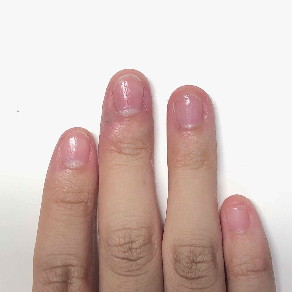 ネイルサポート Na/ネイルネイル/ネイルトップコートを使ったクチコミ(4枚目)