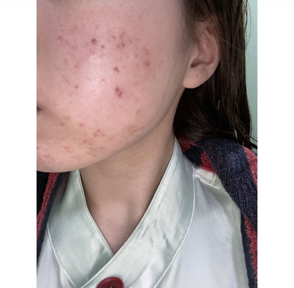 リンクルリペアフォース/ジュレリッチ/リップケアを使ったクチコミ（3枚目）