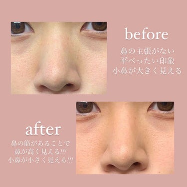 あや🐏 on LIPS 「整形なしでも、綺麗な鼻をゲット出来る👃🏻⭐️私は鼻が低くてコン..」（2枚目）