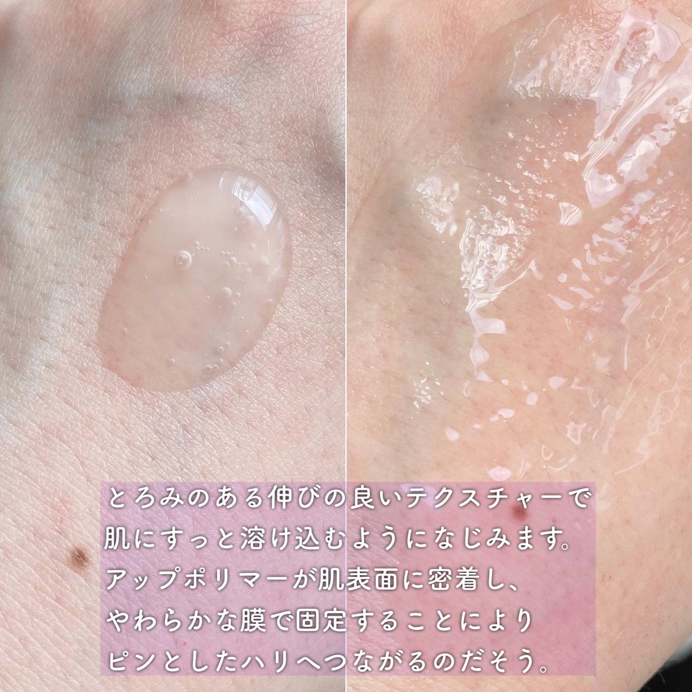 アドバンスバリア セラム (敏感肌用美容液)/iniks/美容液を使ったクチコミ(3枚目)