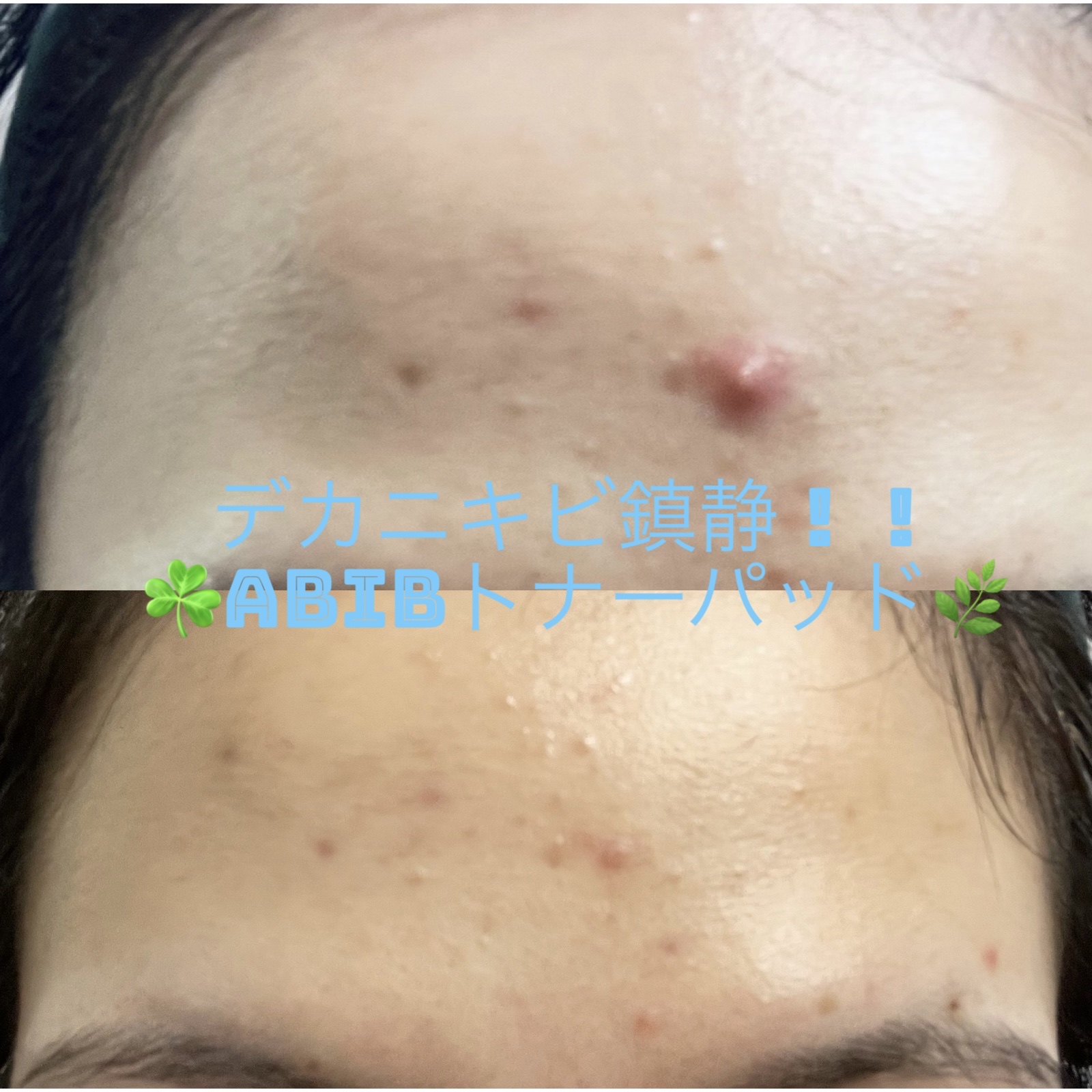 クイック サンスティック プロテクションバー/Abib /日焼け止めスティックを使ったクチコミ（1枚目）