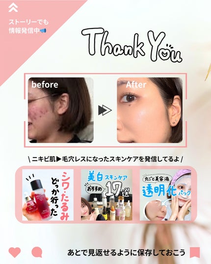 シルクペプチドインテンシブリフティングアンプル/SUNGBOON EDITOR(成分エディター)/美容液を使ったクチコミ(8枚目)