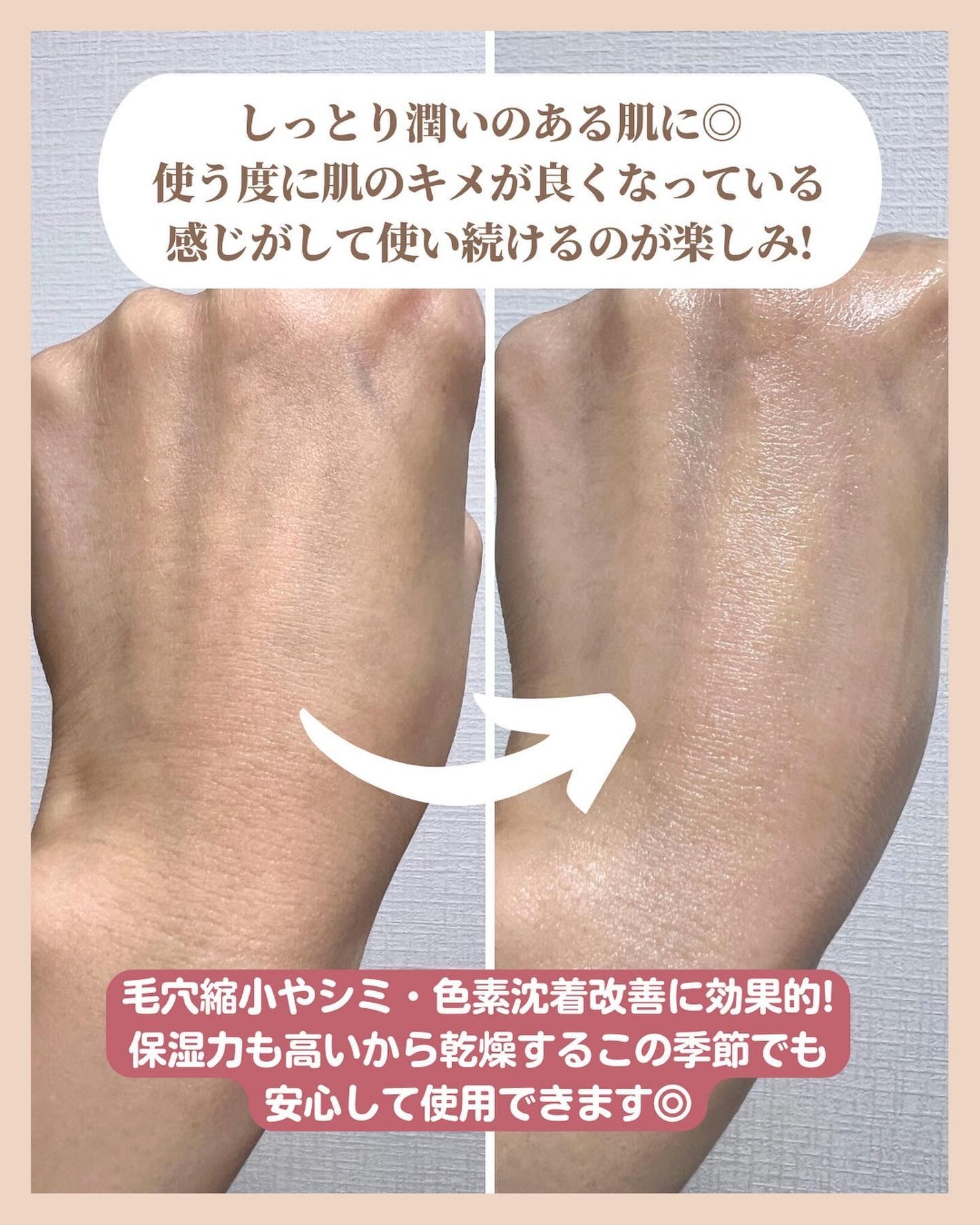 CUREPAIR MELA CREAM /KOPHER/フェイスクリームを使ったクチコミ(5枚目)