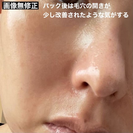 デュイセル プライベートケアマスク/DEWYCEL/シートマスク・パックを使ったクチコミ(6枚目)