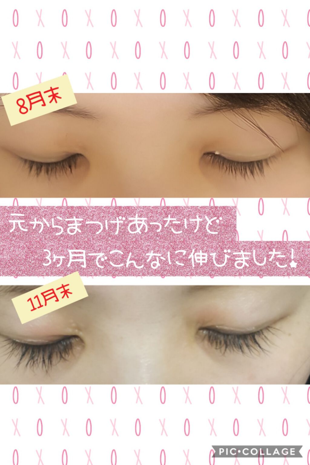 スカルプd ボーテ ピュアフリーアイラッシュセラム プレミアム アンファー スカルプd を使った口コミ 周りからは まつげ長い すごいカールしてる といわれてました By ゆーか 乾燥肌 30代前半 Lips スカルプd ボーテ ピュアフリーアイラッシュセラム プレミアム アンファー スカルプd を使った口コミ 周りからは まつげ長い すごいカールしてる といわれてました By ゆーか 乾燥肌 30代前半 Lips