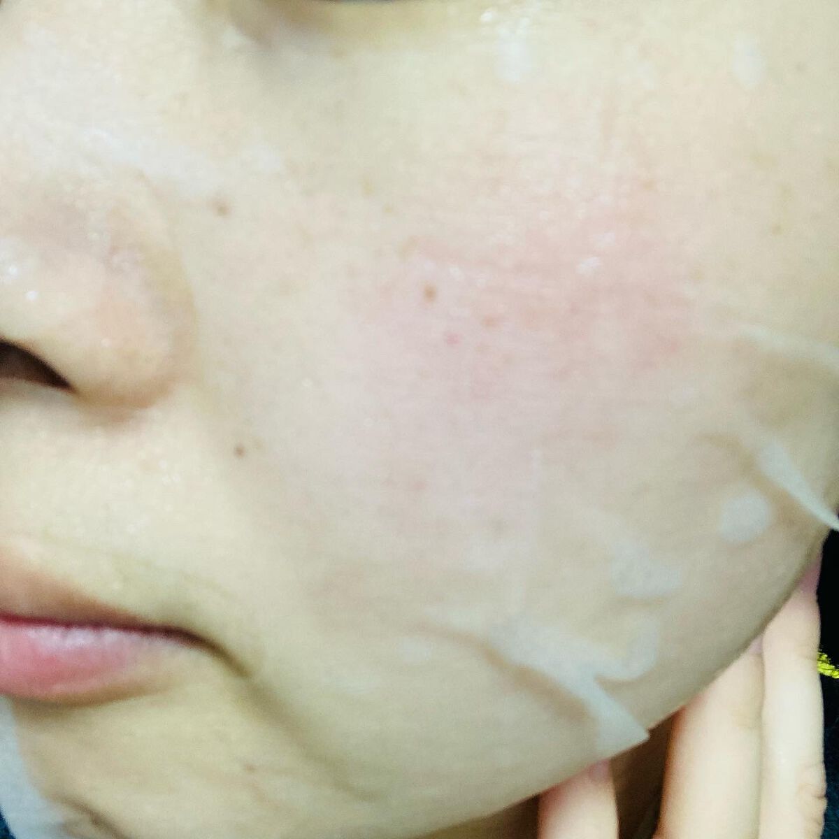 VCクリアマスク/我的美麗日記/シートマスク・パックを使ったクチコミ(4枚目)