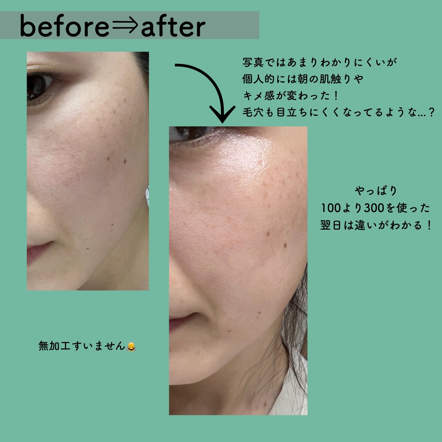 CICA デイリースージングマスク/VT/シートマスク・パックを使ったクチコミ(5枚目)