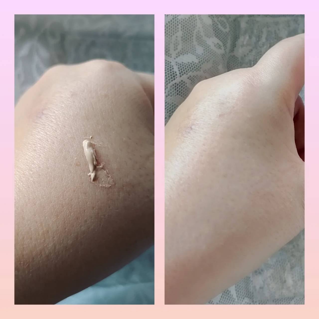 スキンケア ジェリーファンデーション/COVERMARK/その他ファンデーションを使ったクチコミ(3枚目)