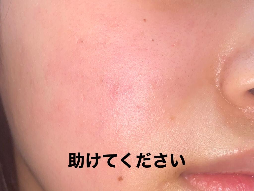 ソフティモ 薬用ホワイト クレンジングウォッシュ/ソフティモ/洗顔フォームを使ったクチコミ(1枚目)