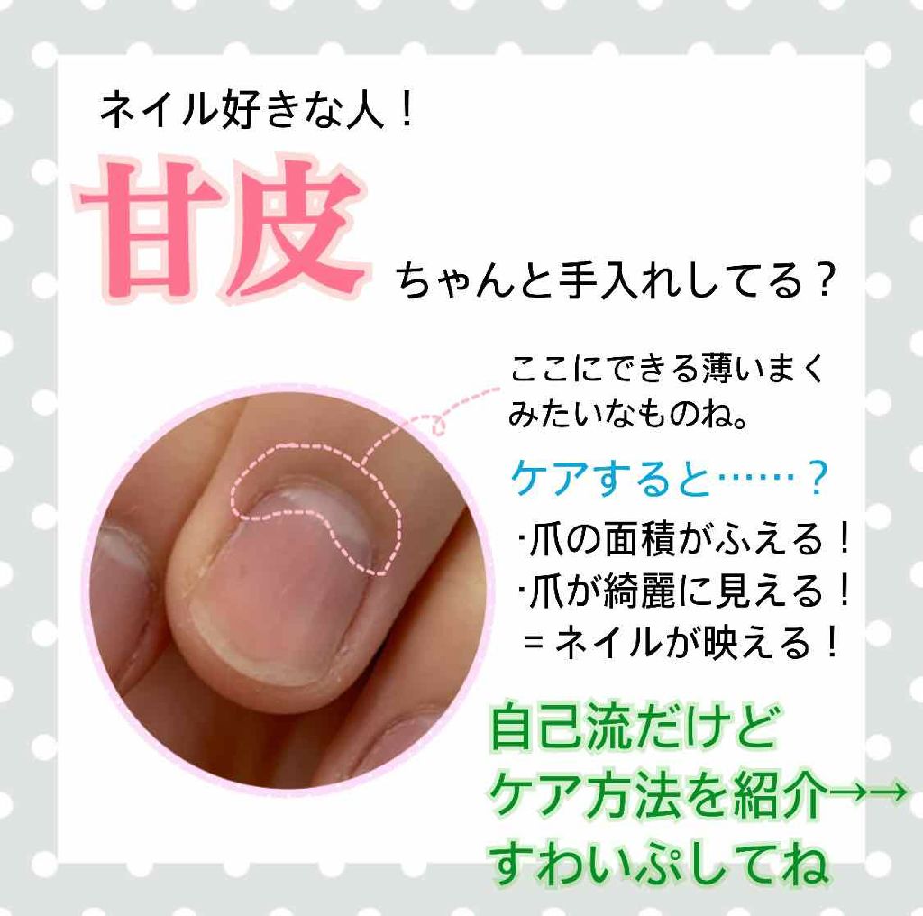 DAISO 毛抜きのクチコミ「甘皮ケアみんなどうしてる？
自己流セルフのお手入れ紹介。
良い方法あったら教えて。

ネイルす.....」（1枚目）