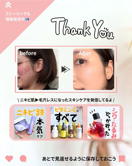 なぎ | スキンケア薬剤師 on LIPS 「◀︎ニキビ肌から毛穴レスになった薬剤師ニキビ・毛穴・シミ・シワ..」(9枚目)