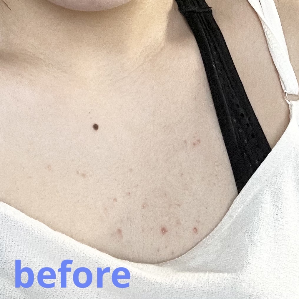 セナキュア(医薬品)/小林製薬/その他を使ったクチコミ（2枚目）