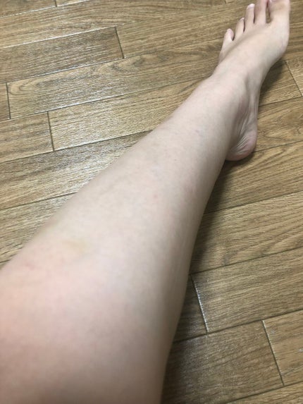 インバスリムーバー/LAXY BLAIR/除毛クリームを使ったクチコミ(6枚目)