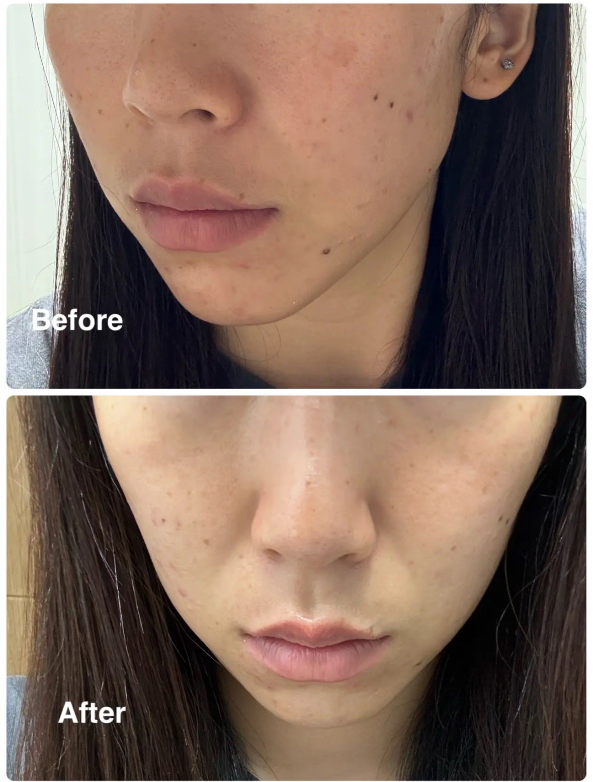 アビブ グルタチオンソームダークスポットセラムビタドロップ/Abib /美容液を使ったクチコミ(7枚目)