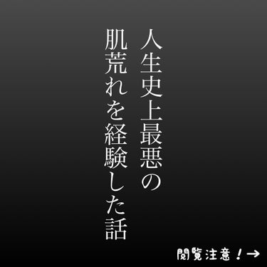 .
.
今回は、これまでの人生のなかで最悪の肌荒れを経験したお話と、回復するまでの過程についてお話をしたいと思います…
汚肌を晒しておりますので、苦手な方はお控えください⚠️
.
.
まず、なぜ肌荒れが