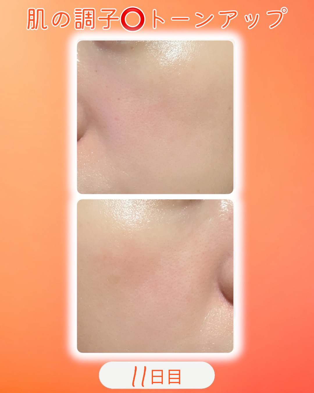 TXトーニングデイリーマスク/VT/その他スキンケアを使ったクチコミ（2枚目）