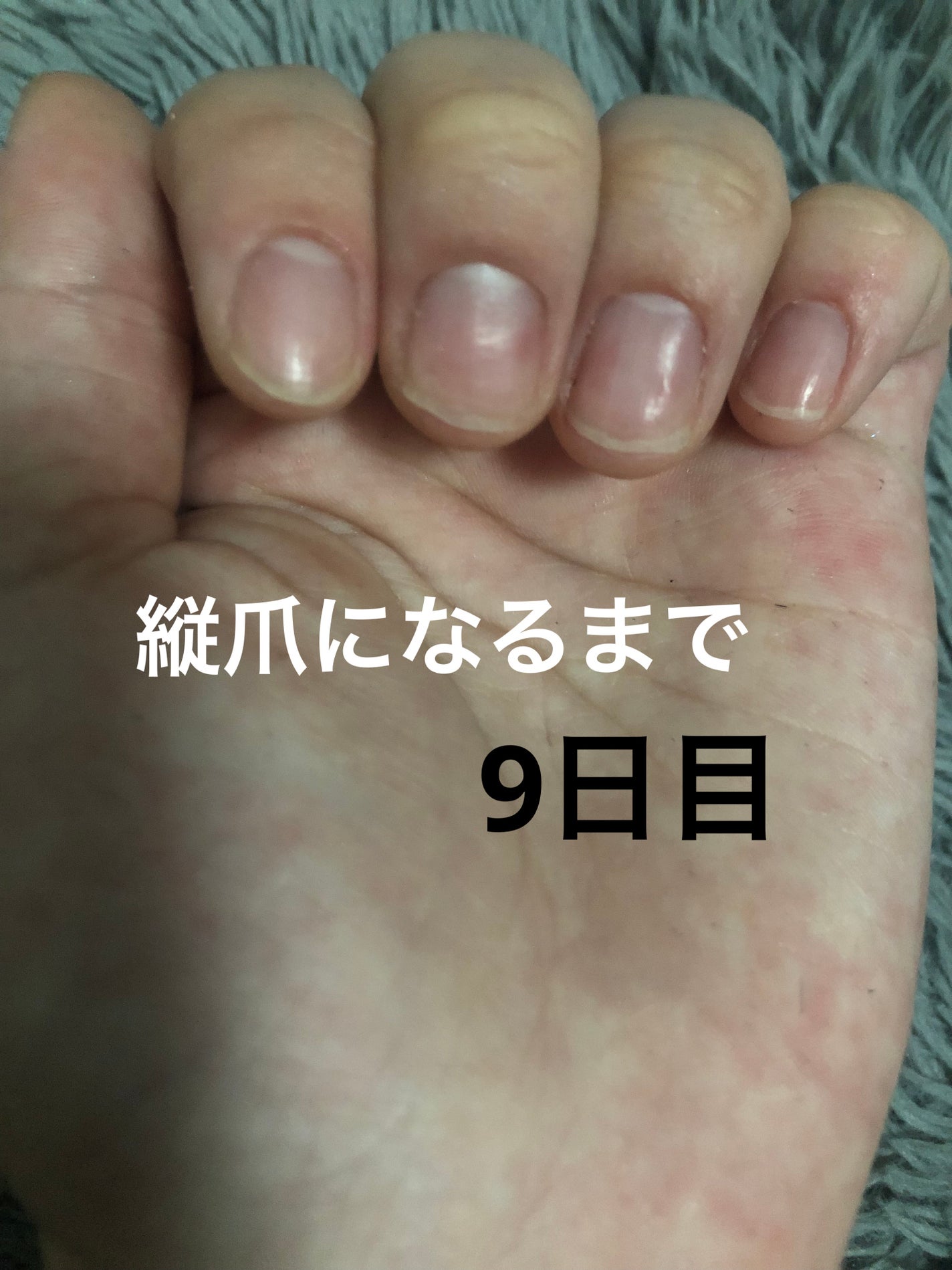 ð on LIPS ã瞊çªã«ãªãããã«ãããããªæ¹æ³ããã£ããæããŠãã ããð#çª_..ãïŒ1æç®ïŒ