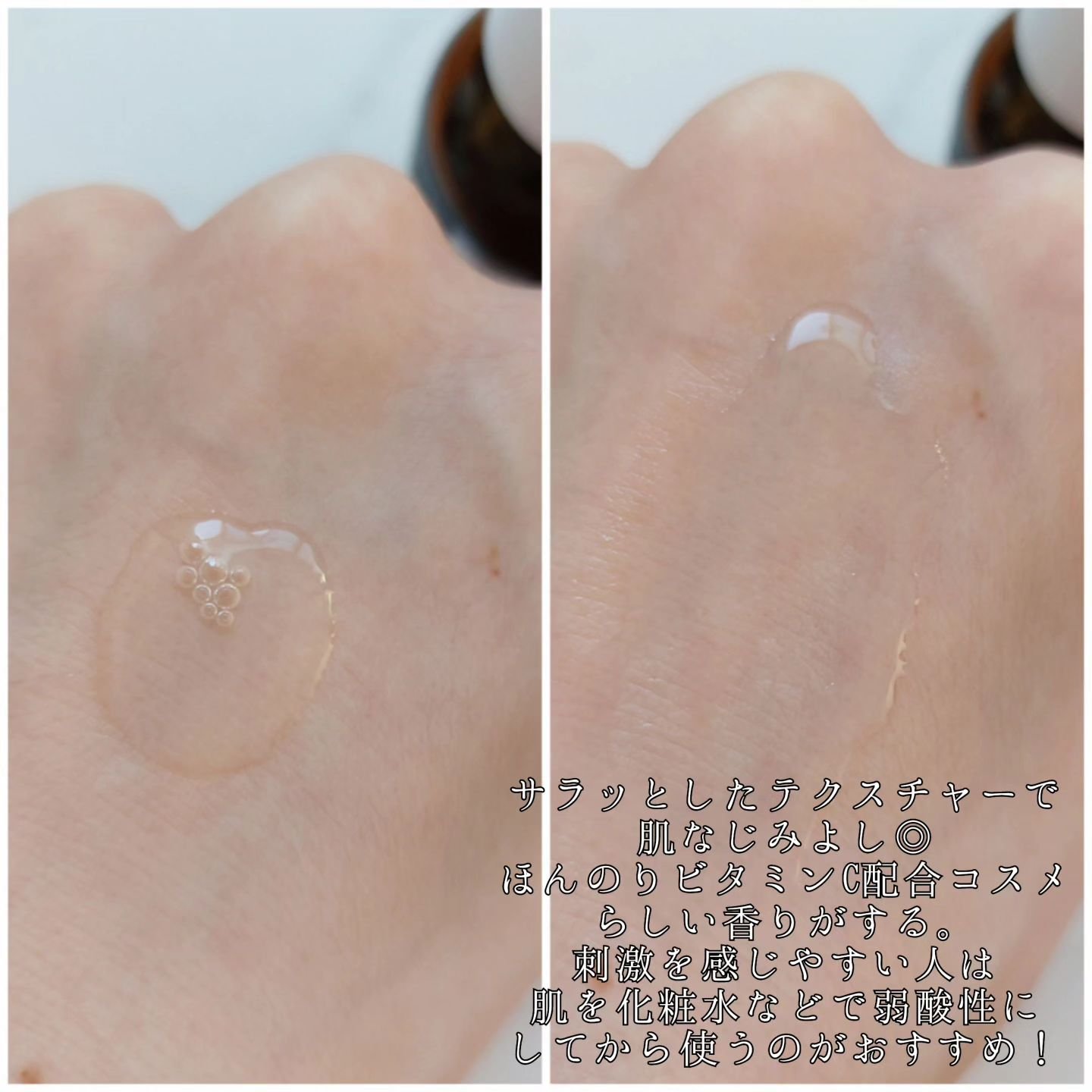 ダーマレーザースペクター ウルセラCMAX/クオリティファースト/美容液を使ったクチコミ（2枚目）