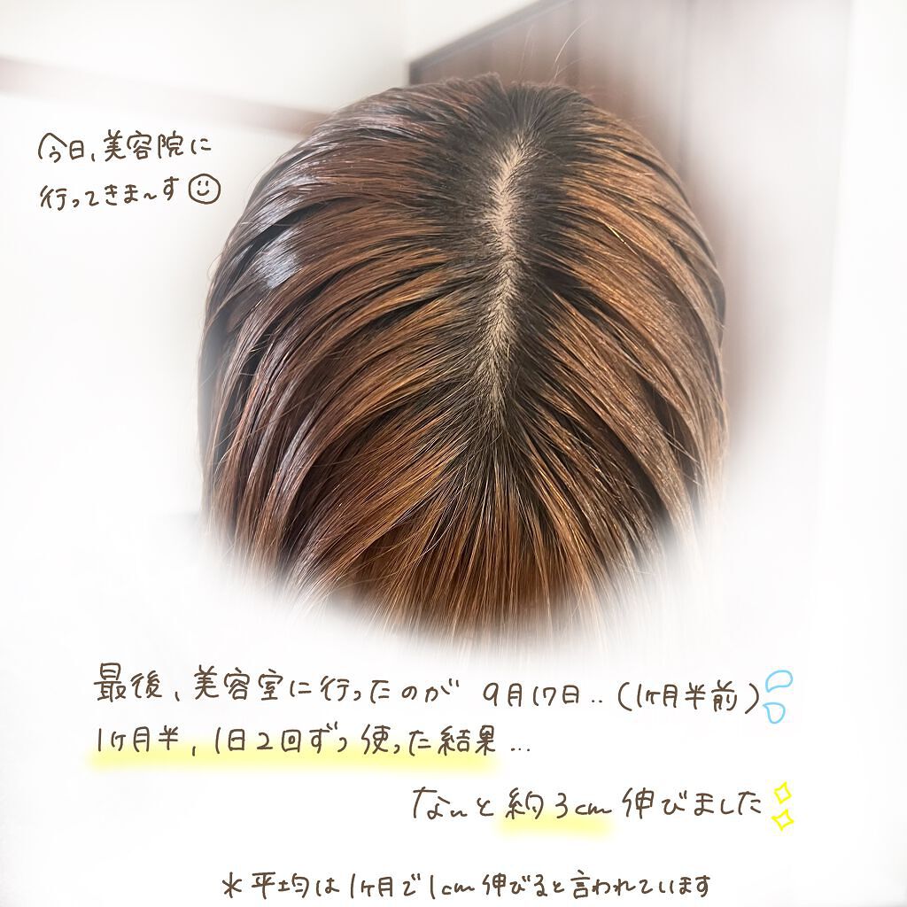 ヘアアクセルレーターex 加美乃素本舗の口コミ 髪を早く伸ばしたい人必見 とにかく早く By みじょちゃん 乾燥肌 代後半 Lips