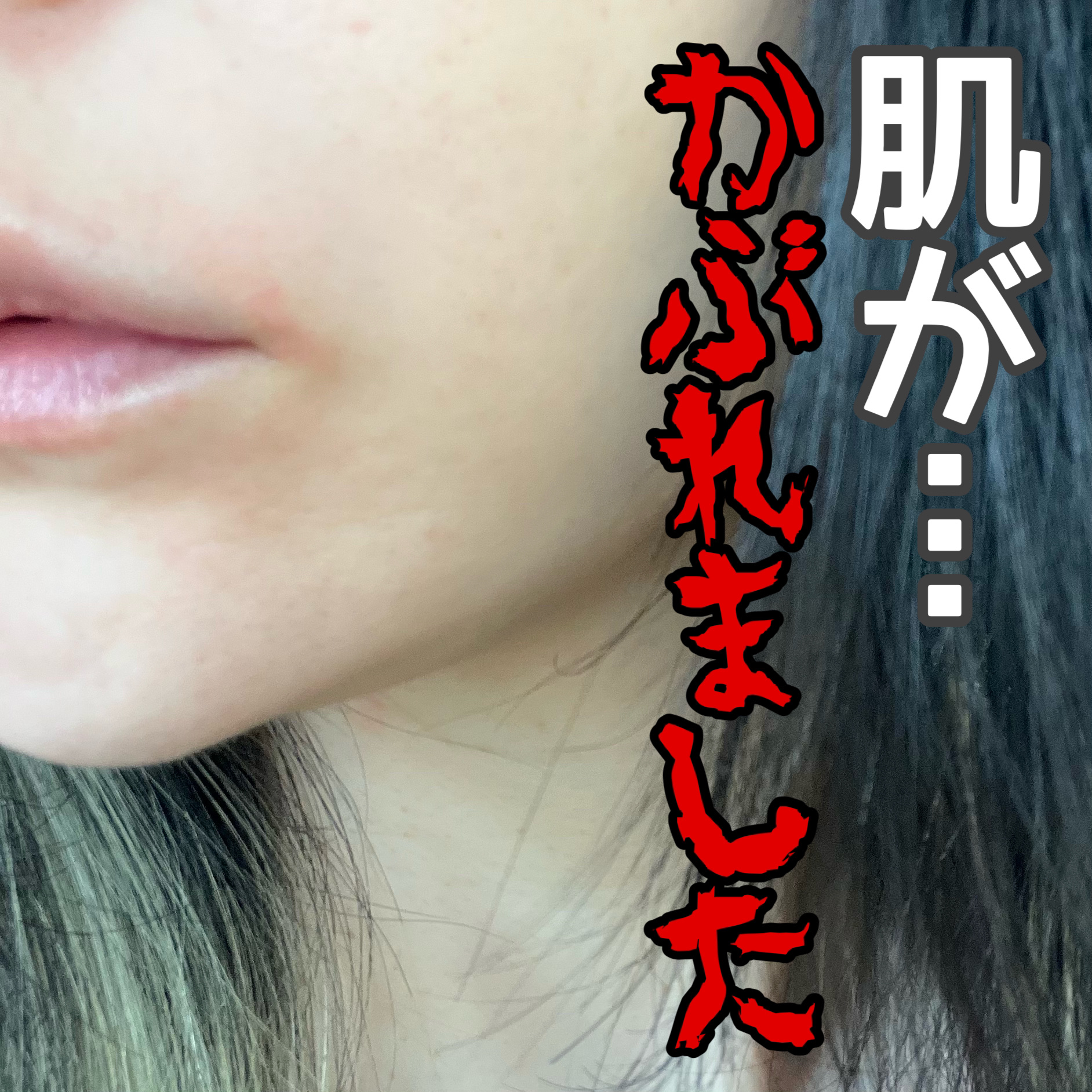 プリスクリードD(医薬品)/IHADA/その他を使ったクチコミ（1枚目）