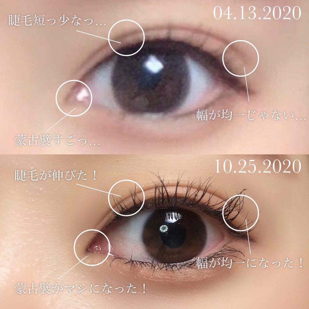 ハトムギ保湿ジェル(ナチュリエ スキンコンディショニングジェル)/ナチュリエ/美容液を使ったクチコミ(2枚目)