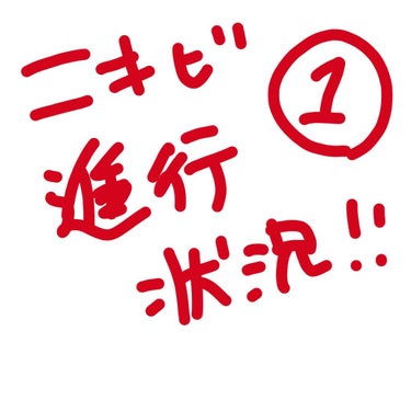 こんにちは、ぽんこです！💓

本日から、ニキビの進行状況を、逐一投稿していそうと思います！！
頻度は、多分三、四日に１回ほどかと思われます💦😭
(ほぼ自分用なんですけどね🙄)

今回は、メイクしてるもの