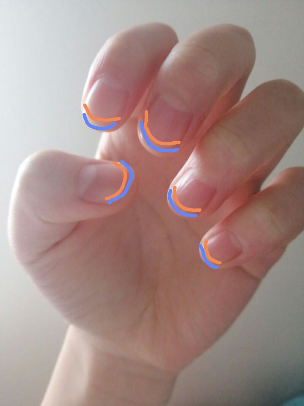 オリジナル ピュアスキンジェリー/ヴァセリン/ボディクリームを使ったクチコミ（2枚目）