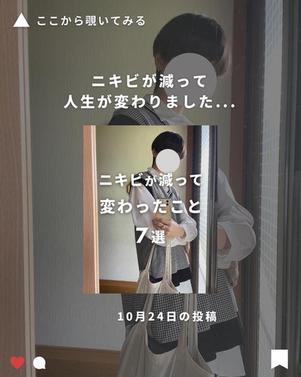 まえけん|ユニセックス美容 on LIPS 「【ニキビが爆増した大学生の末路7選】5年間ニキビに悩まされてき..」(10枚目)