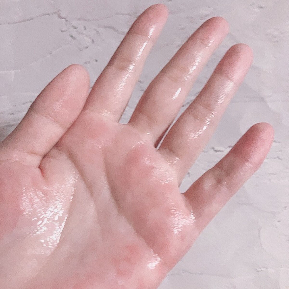 薬用マイクロバブルローション/Macchia Label/化粧水を使ったクチコミ(4枚目)