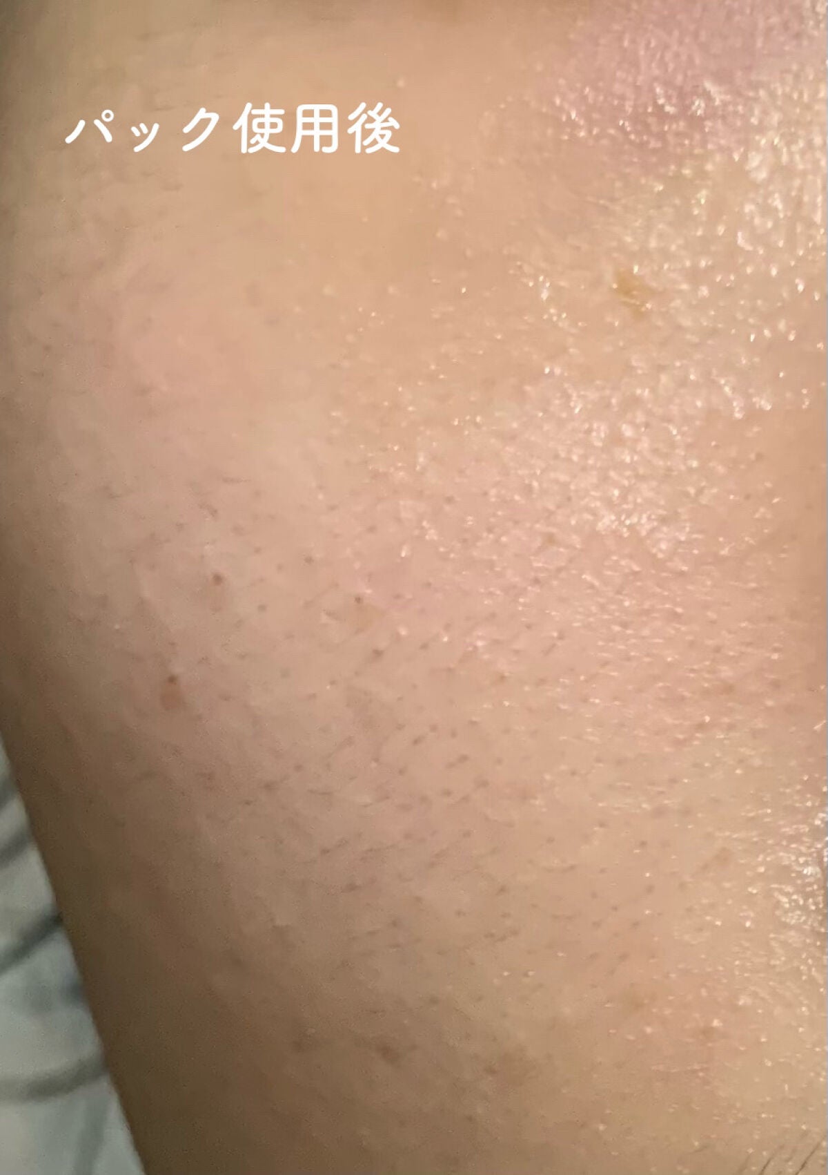 ダーマレーザースーパーVC100マスク/クオリティファースト/シートマスク・パックを使ったクチコミ(8枚目)